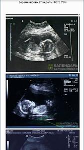 Календарь беременности 1.0 screenshot 4