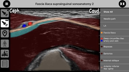 AnSo Anaesthesia Sonoanatomy 2.1.48 screenshot 4